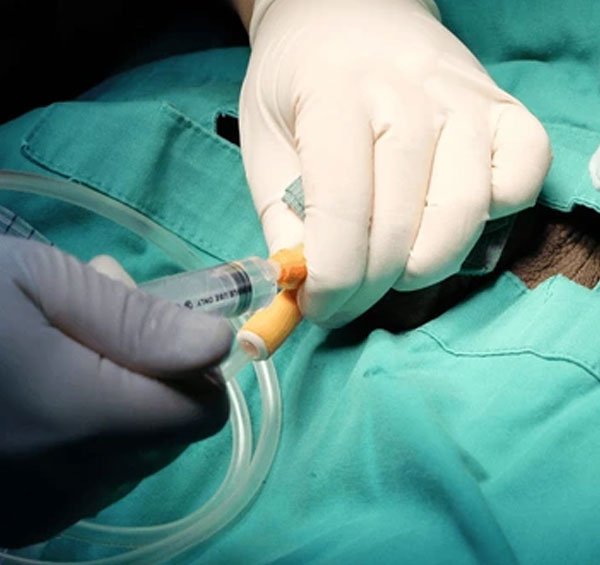 Catheterization Service